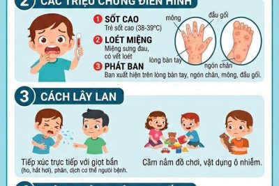 TUYÊN TRUYỀN PHÒNG, CHỐNG BỆNH TAY – CHÂN – MIỆNG Ở TRẺ MẦM NON