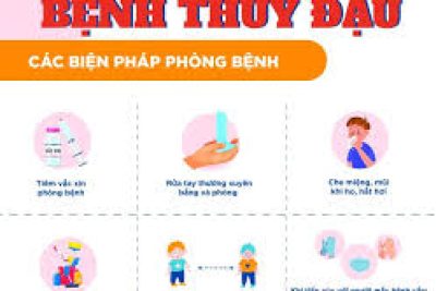 BÀI TUYÊN TRUYỀN PHÒNG CHỐNG BỆNH THUỶ ĐẬU